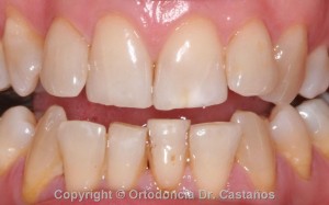 Contorneado dental  «Denticura- Manicura»