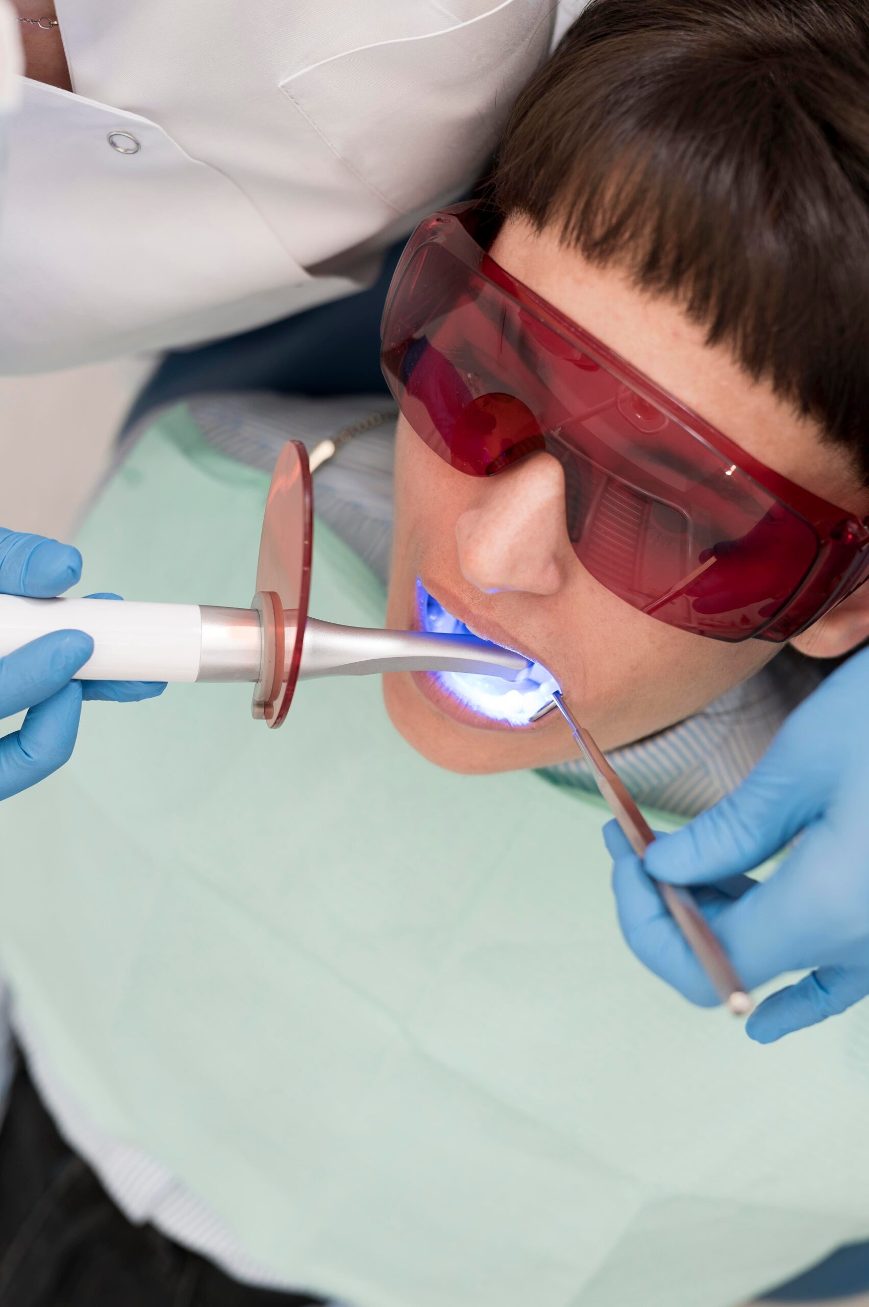 Blanqueamiento dental: Consejos para una sonrisa más brillante