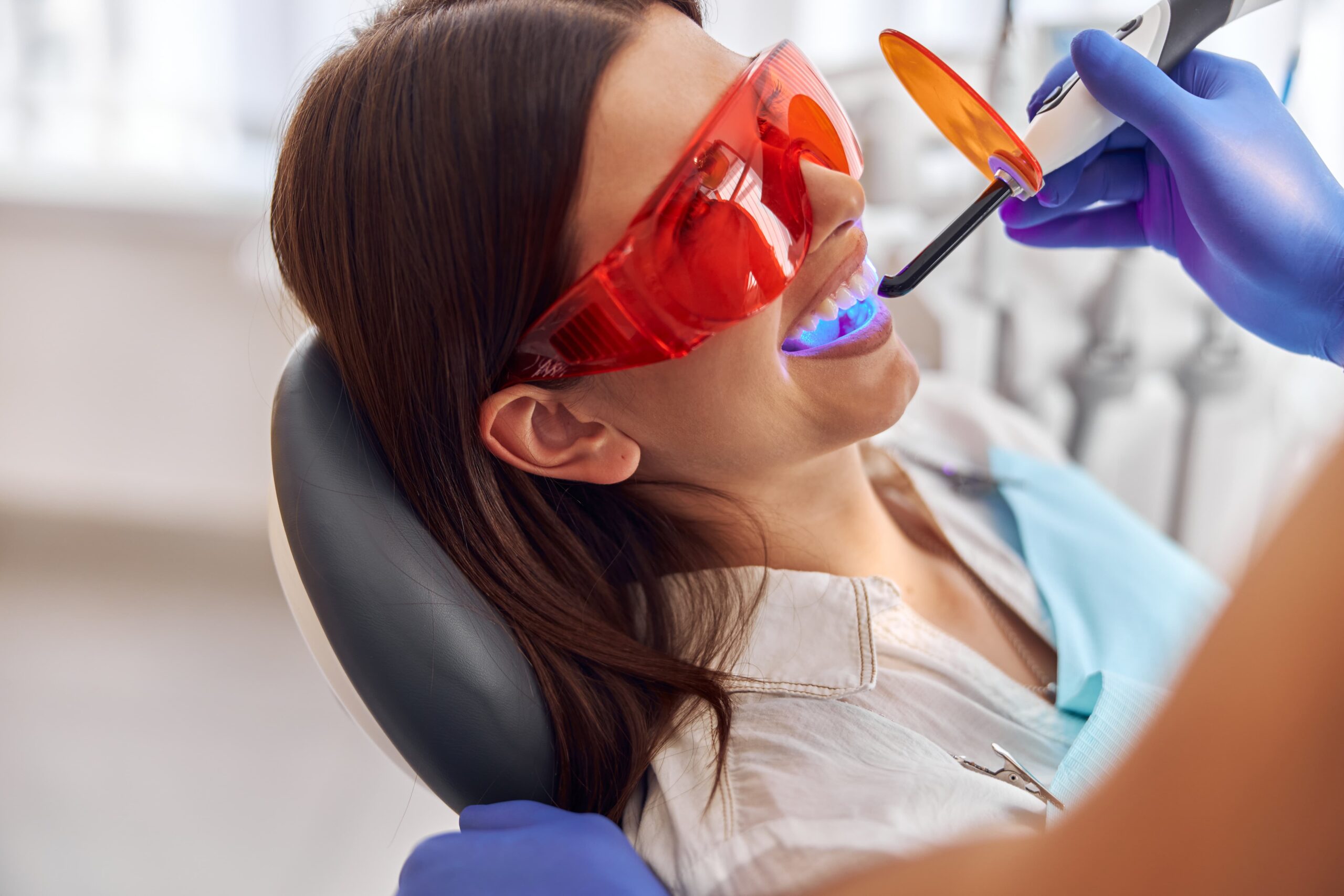 Blanqueamiento dental: Consejos para mantener una sonrisa radiante y duradera